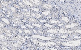 Anti-Integrin &#945;V Antibody, clone 272-17E6 ZooMAb&#174; Mouse Monoclonal recombinant, expressed in HEK 293 cells