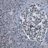 Anti-POSTN antibody produced in rabbit Prestige Antibodies&#174; Powered by Atlas Antibodies, affinity isolated antibody, buffered aqueous glycerol solution