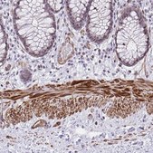 Anti-KCNN4 antibody produced in rabbit Prestige Antibodies&#174; Powered by Atlas Antibodies, affinity isolated antibody, buffered aqueous glycerol solution