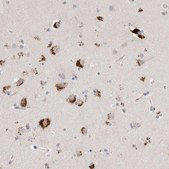 Anti-GGH antibody produced in rabbit Prestige Antibodies&#174; Powered by Atlas Antibodies, affinity isolated antibody, buffered aqueous glycerol solution