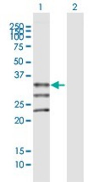 Anti-MOGAT1 antibody produced in mouse purified immunoglobulin, buffered aqueous solution