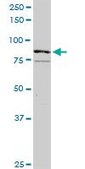 Anti-RASGRP3 antibody produced in rabbit purified immunoglobulin, buffered aqueous solution