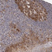 Anti-LTV1 antibody produced in rabbit Prestige Antibodies&#174; Powered by Atlas Antibodies, affinity isolated antibody, buffered aqueous glycerol solution, ab3