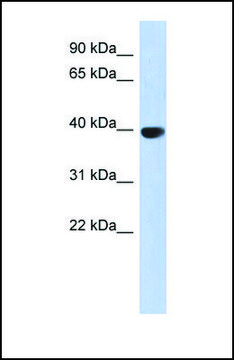 Anti-AURKC antibody produced in rabbit affinity isolated antibody