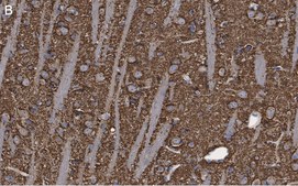 Anti-Synaptophysin Antibody, clone 1G7, ZooMAb&#174; Rabbit Monoclonal recombinant, expressed in HEK 293 cells