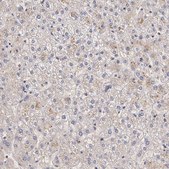Anti-IFNGR2 antibody produced in rabbit affinity isolated antibody, buffered aqueous glycerol solution