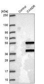 Anti-CXADR antibody produced in rabbit Prestige Antibodies&#174; Powered by Atlas Antibodies, affinity isolated antibody, buffered aqueous glycerol solution, ab2