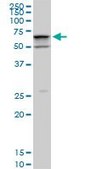 Monoclonal Anti-SMARCD2 antibody produced in mouse clone 2B2, purified immunoglobulin, buffered aqueous solution