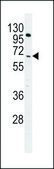 ANTI-COL8A2 (C-TERM) antibody produced in rabbit IgG fraction of antiserum, buffered aqueous solution