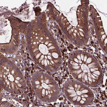 Anti-MYH14 antibody produced in rabbit Prestige Antibodies&#174; Powered by Atlas Antibodies, affinity isolated antibody, buffered aqueous glycerol solution