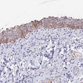 Anti-KRT17 antibody produced in rabbit Prestige Antibodies&#174; Powered by Atlas Antibodies, affinity isolated antibody, buffered aqueous glycerol solution