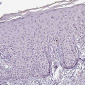 Anti-APOC1 antibody produced in rabbit Prestige Antibodies&#174; Powered by Atlas Antibodies, affinity isolated antibody, buffered aqueous glycerol solution