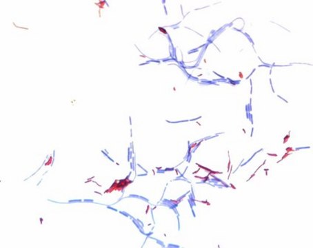 Ziehl-Neelsen carbol-fuchsin solution for microscopy