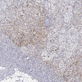 Anti-DLK1 antibody produced in rabbit Prestige Antibodies&#174; Powered by Atlas Antibodies, affinity isolated antibody, buffered aqueous glycerol solution