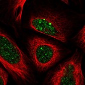 Anti-ALKBH8 antibody produced in rabbit Prestige Antibodies&#174; Powered by Atlas Antibodies, affinity isolated antibody, buffered aqueous glycerol solution
