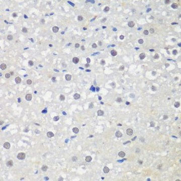 Anti-CTCF antibody produced in rabbit