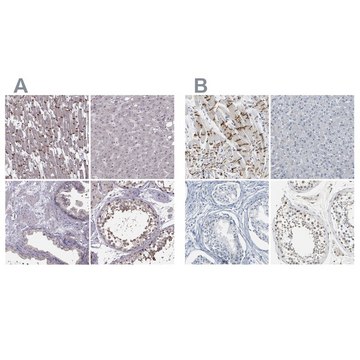 Anti-PKP2 antibody produced in rabbit Prestige Antibodies&#174; Powered by Atlas Antibodies, affinity isolated antibody