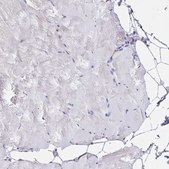 Anti-TFAP2C antibody produced in rabbit Prestige Antibodies&#174; Powered by Atlas Antibodies, affinity isolated antibody, buffered aqueous glycerol solution