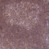 Anti-PRKAR1A antibody produced in rabbit Prestige Antibodies&#174; Powered by Atlas Antibodies, affinity isolated antibody, buffered aqueous glycerol solution