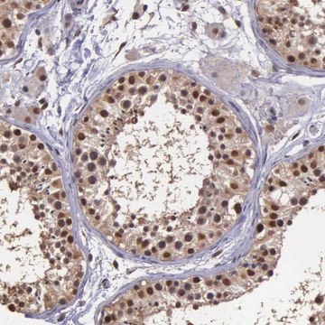 Anti-PSMC1 antibody produced in rabbit Prestige Antibodies&#174; Powered by Atlas Antibodies, affinity isolated antibody, buffered aqueous glycerol solution