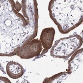 Anti-GPN1 antibody produced in rabbit Prestige Antibodies&#174; Powered by Atlas Antibodies, affinity isolated antibody, buffered aqueous glycerol solution