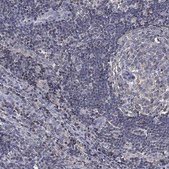 Anti-ADPRHL1 antibody produced in rabbit Prestige Antibodies&#174; Powered by Atlas Antibodies, affinity isolated antibody, buffered aqueous glycerol solution