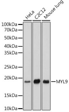 Anti-MYL9 Antibody, clone 4C9E8, Rabbit Monoclonal