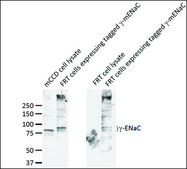 Anti-SCNN1G antibody produced in rabbit 1&#160;mg/mL, affinity isolated antibody