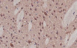 Anti-Kallikrein 6/KLK6 Antibody, clone E24 clone E24, from mouse