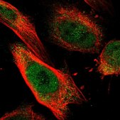 Anti-DSE antibody produced in rabbit Prestige Antibodies&#174; Powered by Atlas Antibodies, affinity isolated antibody, buffered aqueous glycerol solution