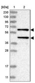 Anti-PPM1A antibody produced in rabbit Prestige Antibodies&#174; Powered by Atlas Antibodies, affinity isolated antibody, buffered aqueous glycerol solution