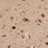 Anti-PSMD1 antibody produced in rabbit Prestige Antibodies&#174; Powered by Atlas Antibodies, affinity isolated antibody, buffered aqueous glycerol solution