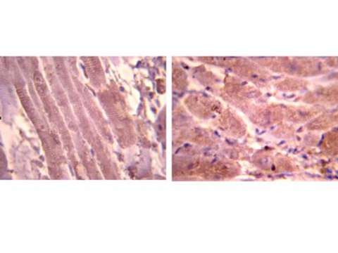 Anti-Atrial Natriuretic Polypetide Antibody, alpha from rabbit