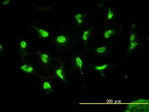 Monoclonal Anti-HDAC11 antibody produced in mouse clone 1C2-2G5, purified immunoglobulin, buffered aqueous solution