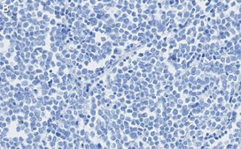 Anti-MyoD Antibody, clone 1F22 ZooMAb&#174; Rabbit Monoclonal recombinant, expressed in HEK 293 cells