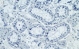 Anti-ATG16L Antibody, clone 1I5 ZooMAb&#174; Rabbit Monoclonal recombinant, expressed in HEK 293 cells