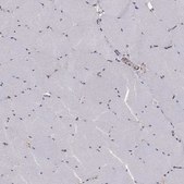 Anti-SLC2A13 antibody produced in rabbit Prestige Antibodies&#174; Powered by Atlas Antibodies, affinity isolated antibody, buffered aqueous glycerol solution