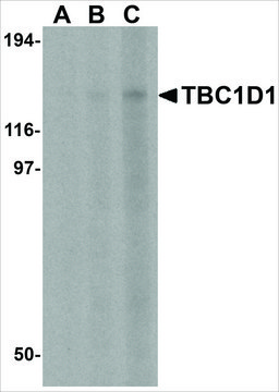Anti-TBC1D1 antibody produced in rabbit affinity isolated antibody, buffered aqueous solution