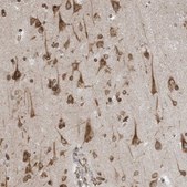 Anti-WWP1 antibody produced in rabbit Prestige Antibodies&#174; Powered by Atlas Antibodies, affinity isolated antibody, buffered aqueous glycerol solution