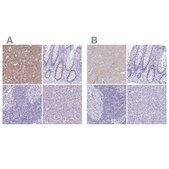 Anti-VGAT antibody produced in rabbit Prestige Antibodies&#174; Powered by Atlas Antibodies, affinity isolated antibody, buffered aqueous glycerol solution