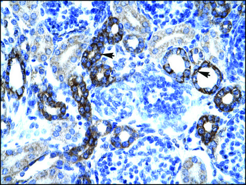 Anti-BTG2 affinity isolated antibody