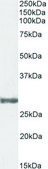Anti-COMT (Internal) antibody produced in goat affinity isolated antibody, buffered aqueous solution
