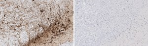 Anti-Tyrosine Hydroxylase Antibody, clone 2/40/15 ZooMAb&#174; Mouse Monoclonal recombinant, expressed in HEK 293 cells
