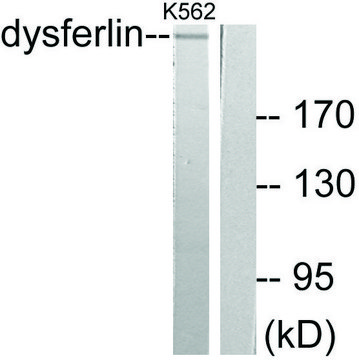 Anti-Dysferlin, antibody produced in rabbit affinity isolated antibody