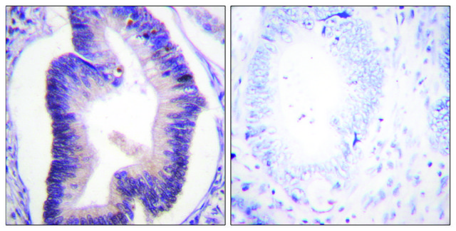Anti-Fructose 6 Phosphate Kinase antibody produced in rabbit affinity isolated antibody