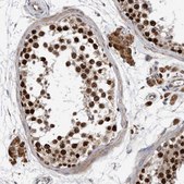 Anti-ATAD2 antibody produced in rabbit Prestige Antibodies&#174; Powered by Atlas Antibodies, affinity isolated antibody, buffered aqueous glycerol solution