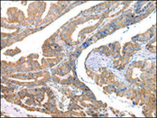 Anti-COL8A2 affinity isolated antibody