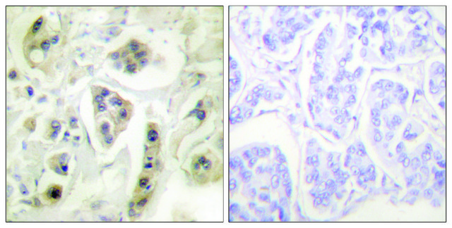 Anti-HSP60 antibody produced in rabbit affinity isolated antibody