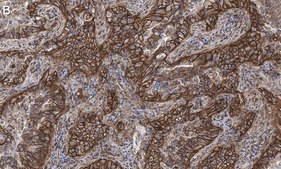 Anti-Integrin pan-&#945;V Antibody, clone EM01309 , ZooMAb&#174; Rabbit Monoclonal recombinant, expressed in HEK 293 cells