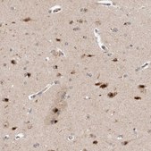 Anti-TMEM65 antibody produced in rabbit Prestige Antibodies&#174; Powered by Atlas Antibodies, affinity isolated antibody, buffered aqueous glycerol solution